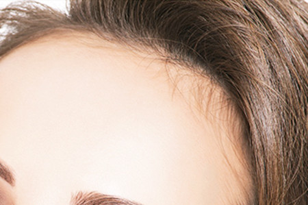 武漢植發(fā)整形醫(yī)院排名更新！實(shí)力口碑醫(yī)院推薦！