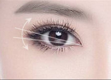 桂林開眼角整形醫(yī)院哪幾家好？10家正規(guī)機(jī)構(gòu)供你挑選！