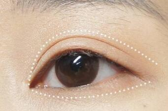 煙臺(tái)雙眼皮修復(fù)整形醫(yī)院哪幾家技術(shù)好？這10家醫(yī)院不容錯(cuò)過！