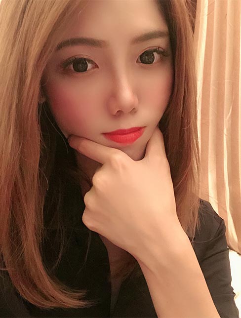 肋軟骨鼻綜合案例：術(shù)后效果