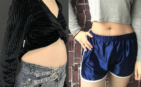 360度環(huán)吸抽脂多少錢?效果怎么樣?