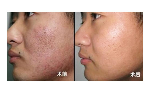 黑臉娃娃有風(fēng)險(xiǎn)嗎？