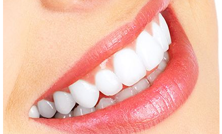 四環(huán)素牙如何美白多少錢？
