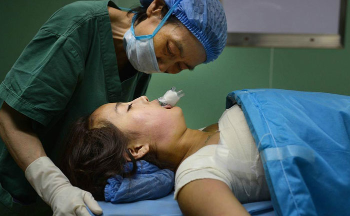 假體隆胸效果自然嗎？能維持多久？