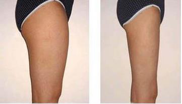 臀部下垂怎么提升？