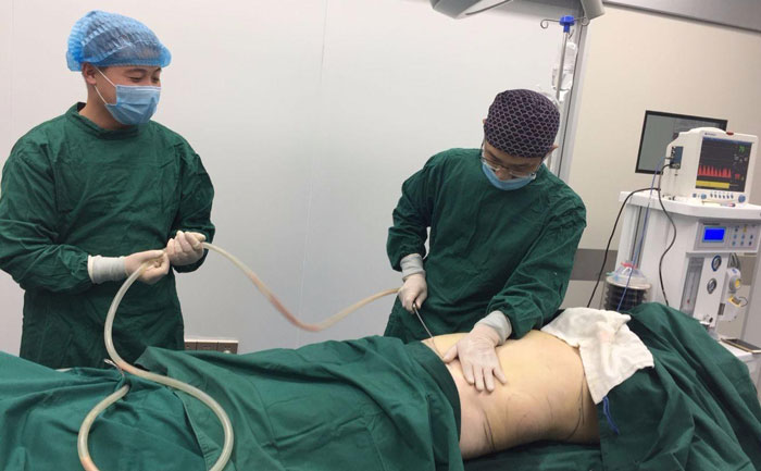 吸脂提臀線是怎么樣的？吸脂提臀多少錢？