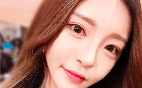 韓式開眼角的費用是多少？