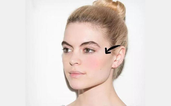 玻尿酸豐蘋(píng)果肌怎么樣？