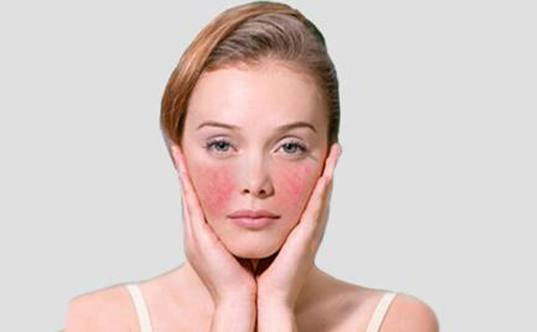 激光去紅血絲的原理是什么？