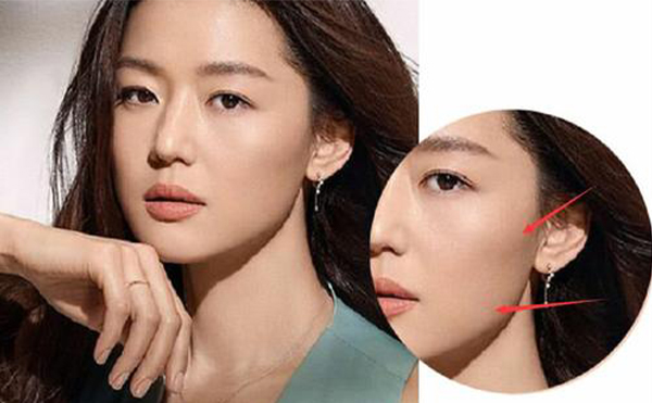 胖人先胖臉，請(qǐng)問(wèn)該怎么瘦臉?