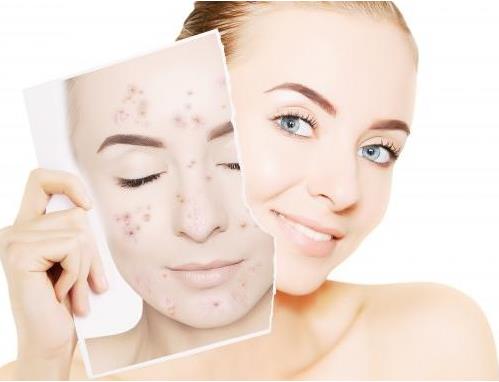 面部提拉緊致繃帶有效果嗎？