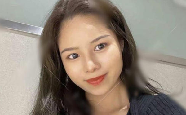 鼻再造手術(shù)成功率高嗎？