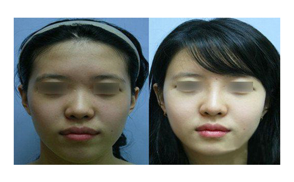 做白瓷娃娃多少錢？