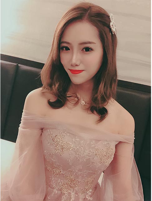 肋軟骨鼻綜合案例：術(shù)后效果1