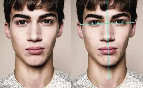 面部不對(duì)稱怎么矯正?具體有哪些方法?