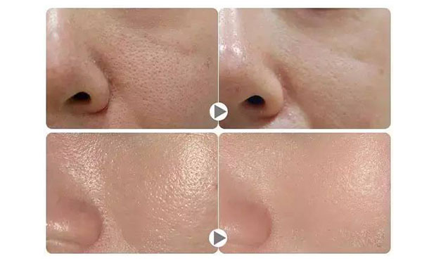 黑臉娃娃的價(jià)格是多少？