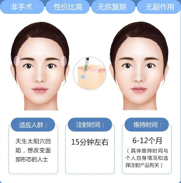 豐太陽穴多少錢？