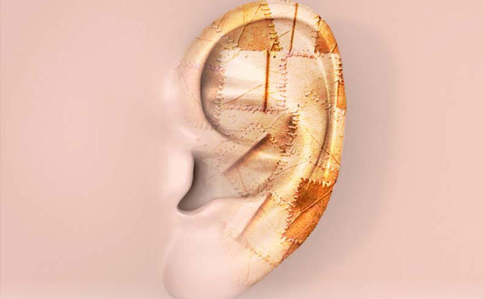 耳再造手術(shù)對軟骨有影響嗎？