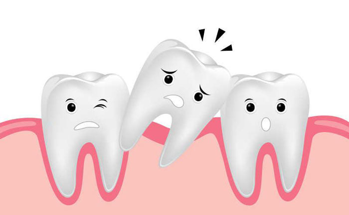 牙齒松動還能恢復嗎？