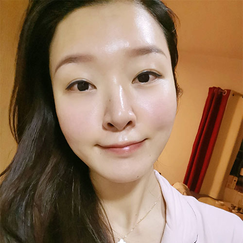 熱拉提手術(shù)效果圖2