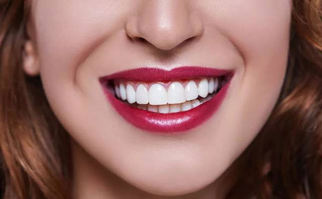 牙齒貼面怎么做？