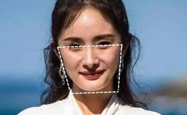 下頜角整形手術(shù)后皮膚會松弛嗎?