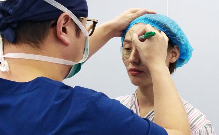 自體脂肪填充面部能保持多長時(shí)間？