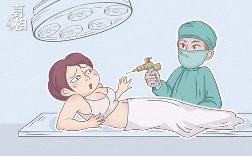 全身脂肪大概要多少錢？