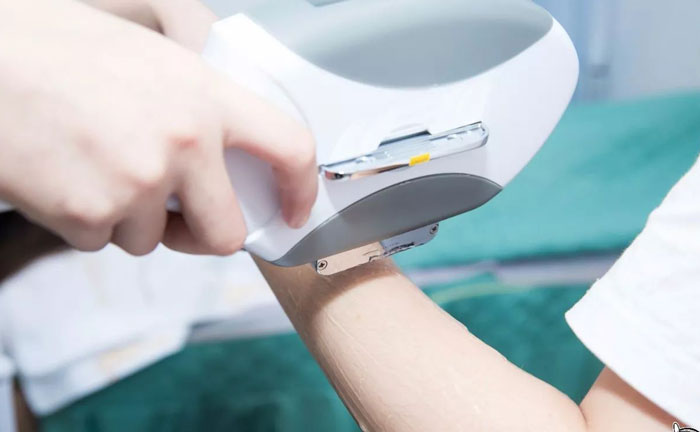 手臂脫毛多少錢？手臂脫毛幾次干凈？