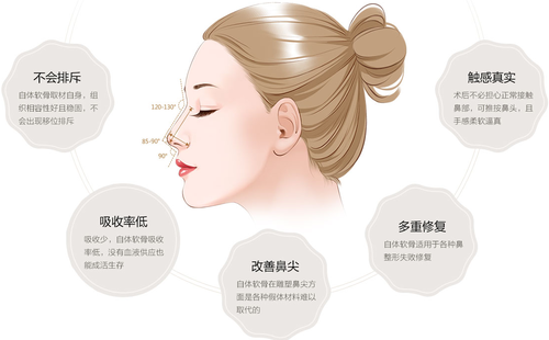 自體軟骨隆鼻可以永久的嗎？