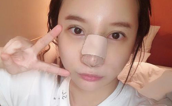 什么情況下需要取出隆鼻假體?取出后鼻子會變形嗎?