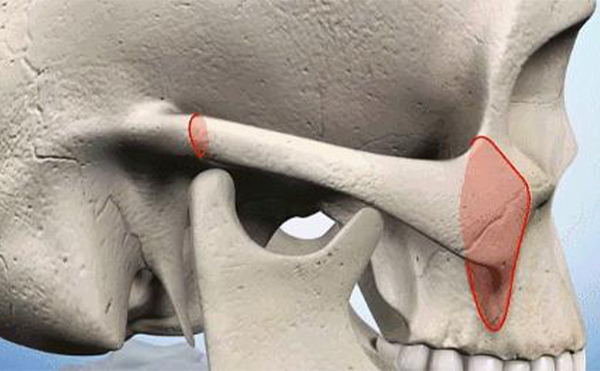 顴骨內(nèi)推和磨顴骨的區(qū)別是什么?