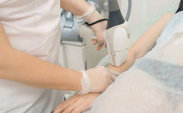 冰點(diǎn)脫毛的步驟是什么?有哪些需要注意的?