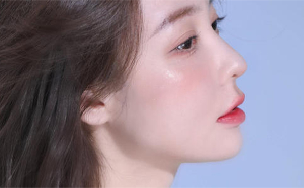 隆鼻失敗修復(fù)術(shù)后注意事項