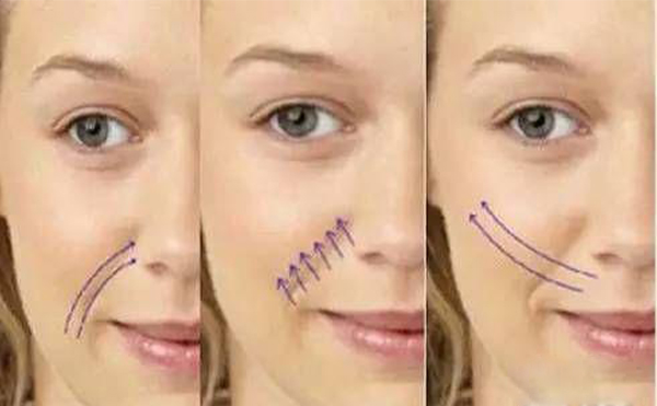 線雕和玻尿酸填充哪個效果好?應該怎么選?