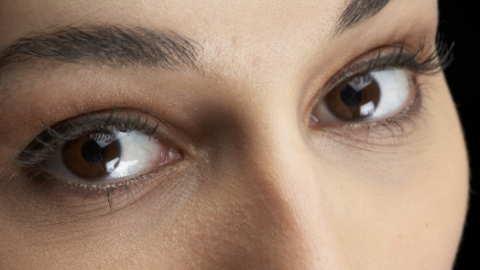 激光雙眼皮手術(shù)需要恢復(fù)多久？