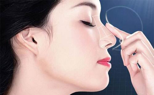 哪些人不能做鼻小柱缺損的修復(fù)手術(shù)?做鼻小柱缺損修復(fù)術(shù)前應(yīng)注意什么?