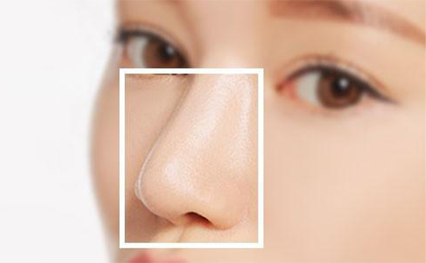 假體隆鼻后鼻子會發(fā)生變形嗎?這與什么因素有關(guān)?