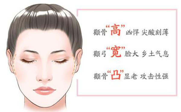 顴骨內(nèi)推整形適宜人群？