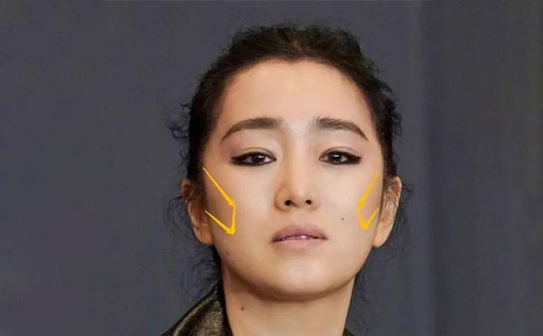 什么原因?qū)е嘛E骨外擴(kuò)？