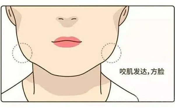 為什么咬肌會(huì)肥大？