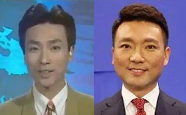 治療咬肌肥大的方法有哪些？