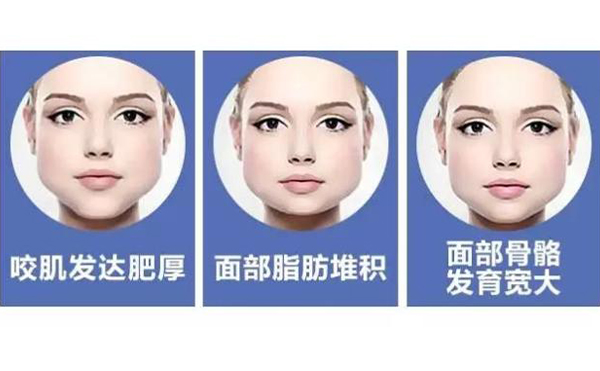 不想通過(guò)醫(yī)美整形的方式改善咬肌肥大就該這么做!