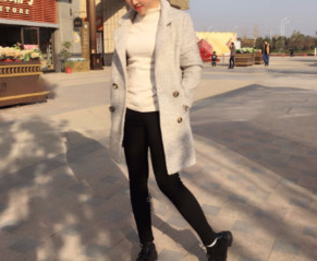 太原時(shí)光整形王國(guó)軍大腿吸脂案例3