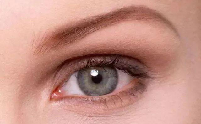 歐式雙眼皮是什么樣的？