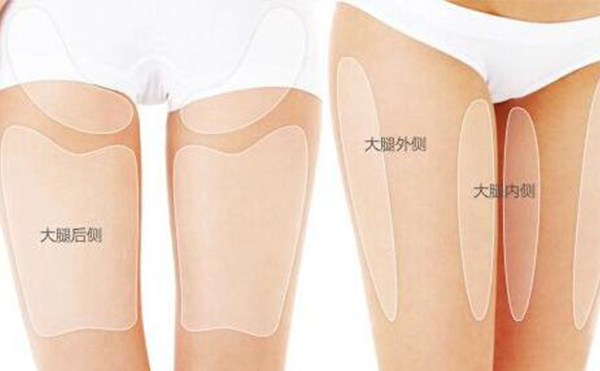 大腿吸脂的部位有哪些？