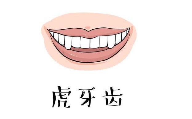 虎牙矯正需要多久？