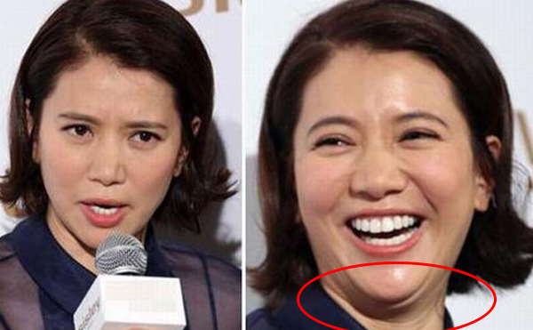 去雙下巴的方法