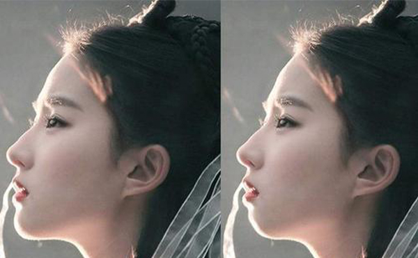 哪些手術(shù)可以達(dá)到改臉型的效果?墊下巴靠譜嗎?