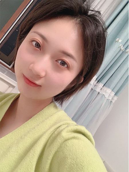 水光針注射效果圖3